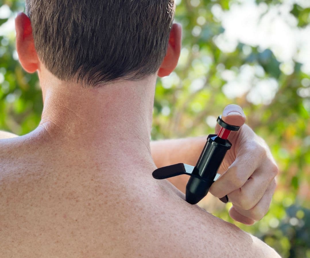 トリガーポイント　整骨院　カイロプラクティック　整体