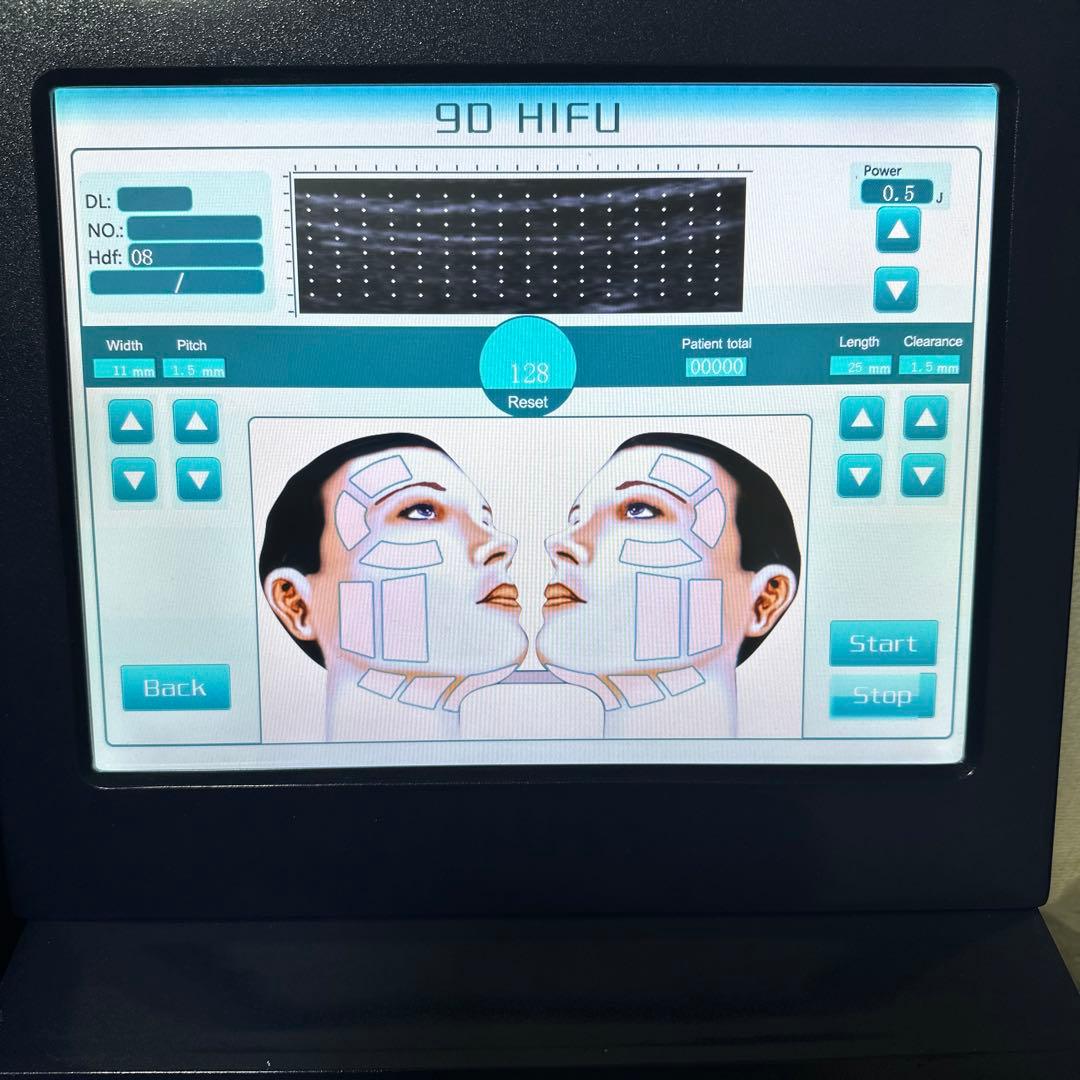 9D HIFU 美容機器 (ネイビーブルー)