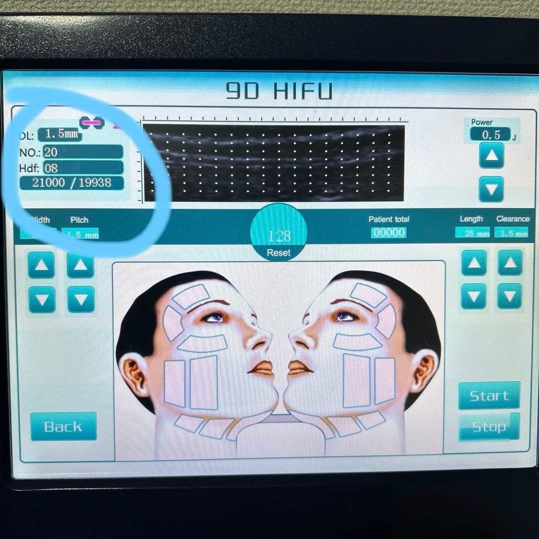 9D HIFU 美容機器 (ネイビーブルー)