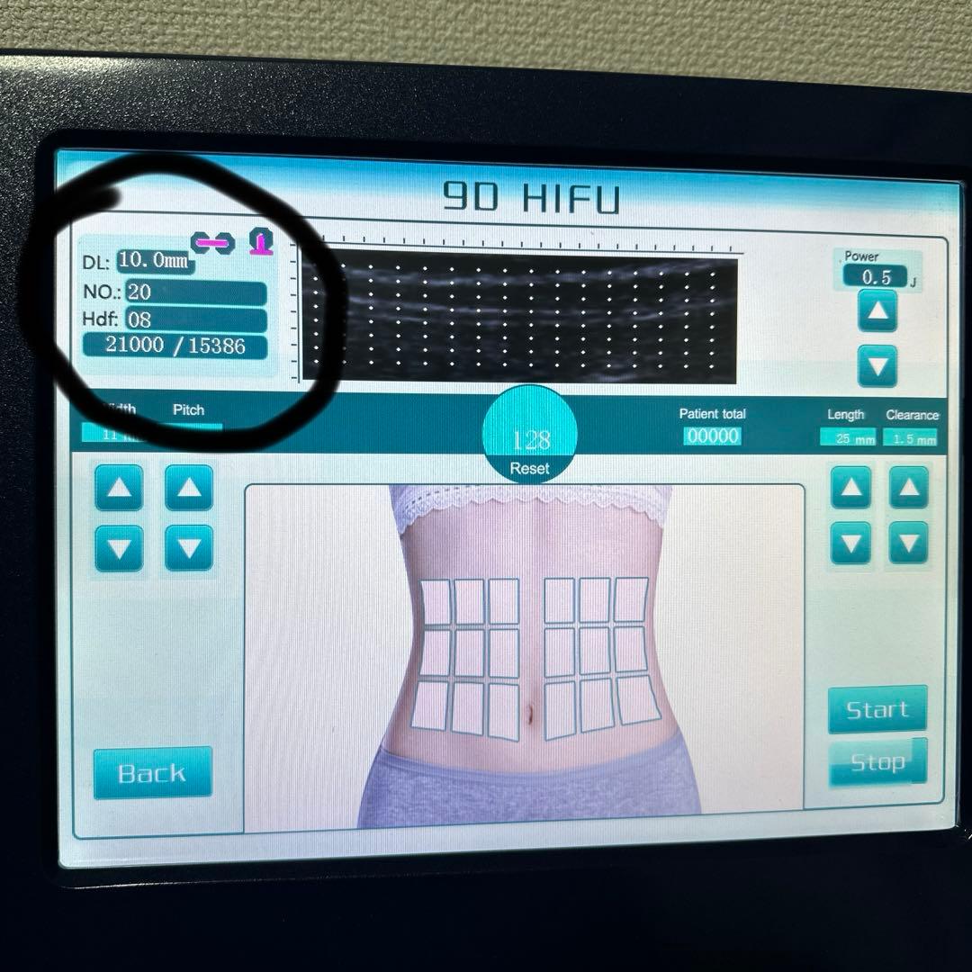 9D HIFU 美容機器 (ネイビーブルー)