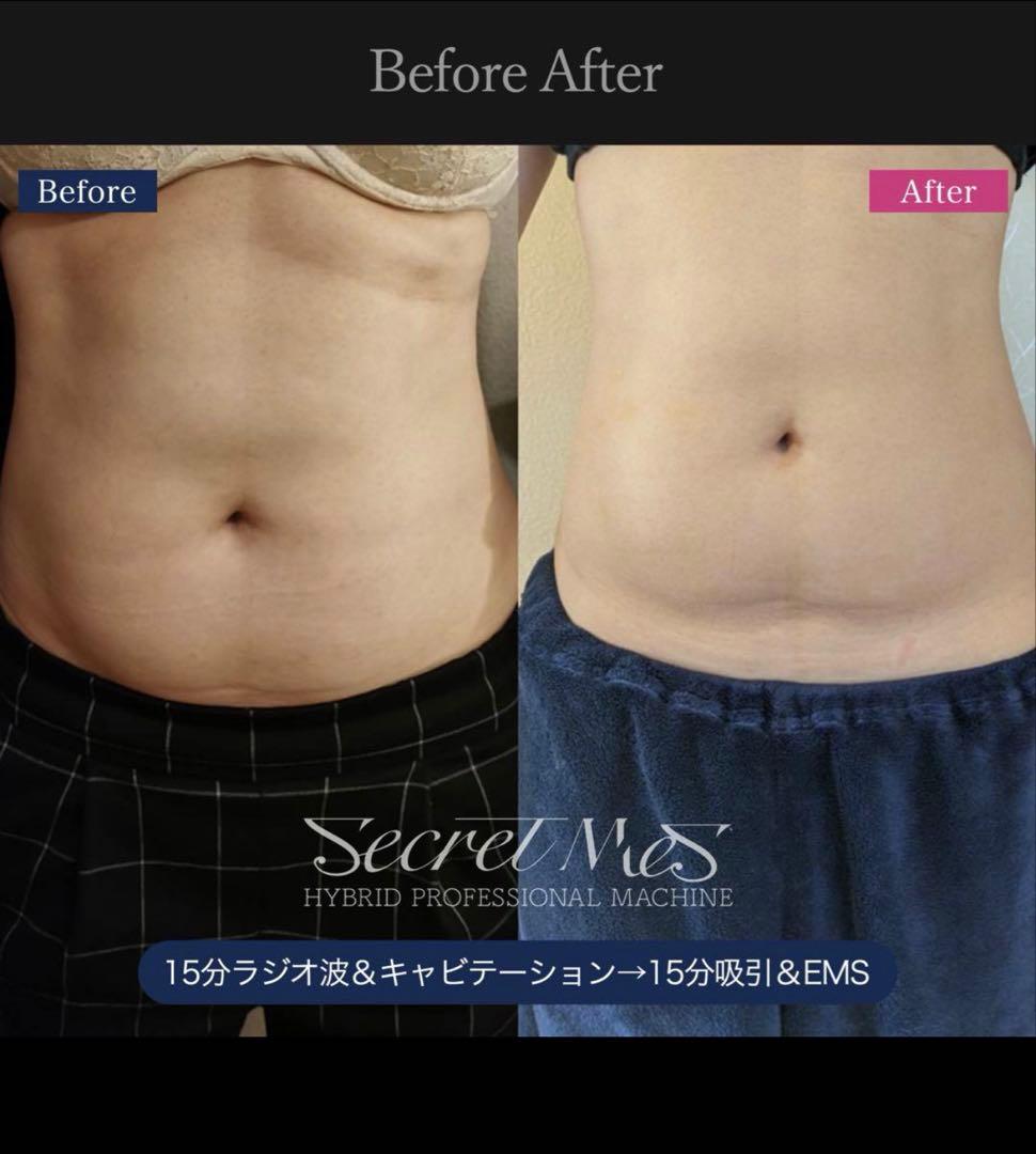 《美品》Secretmes 【シークレットメス】/残り１台/定価260万円