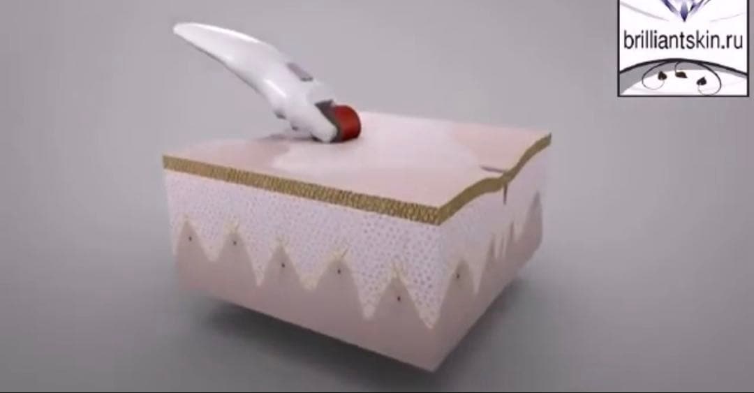 【GENOSYS/高級ダーマローラー 電動】