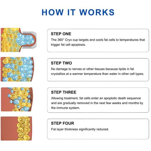 価格が値下‼️多機能な脂肪冷却 痩身マシン
