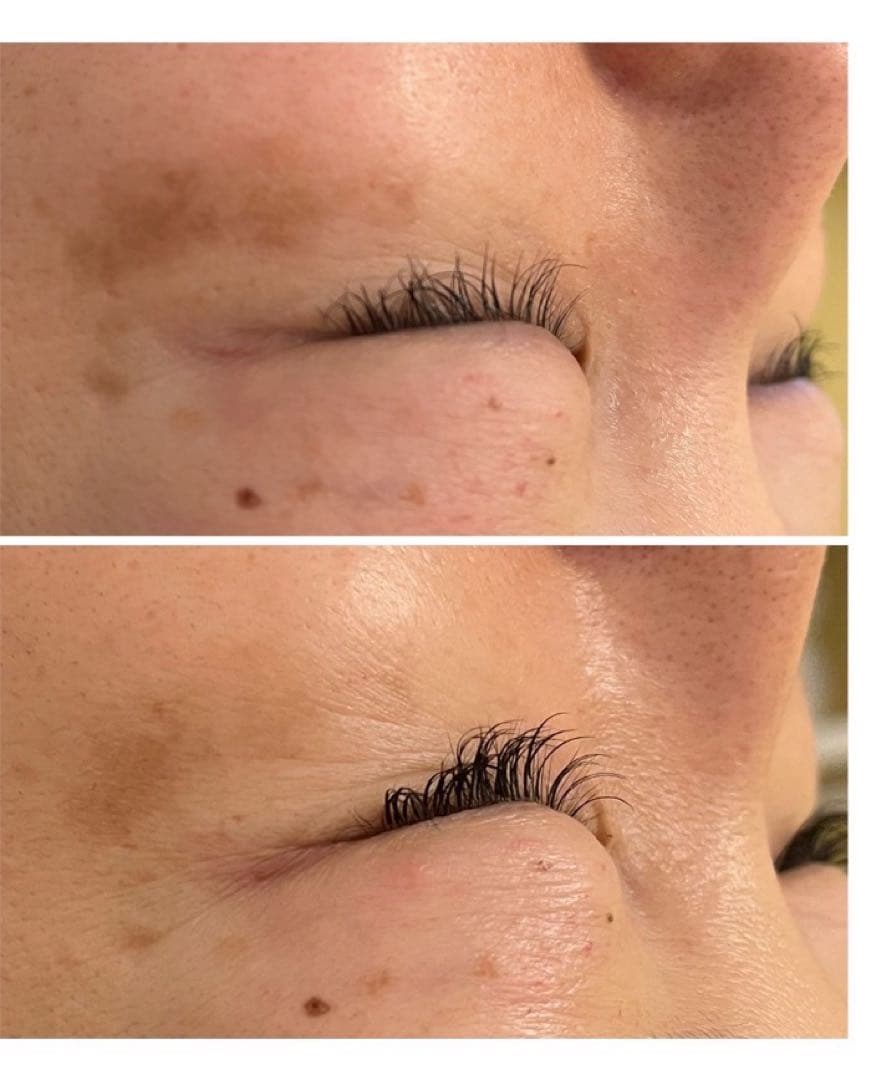 低周波ペンシル　シミケア機　リシルク　ReSilk セット販売