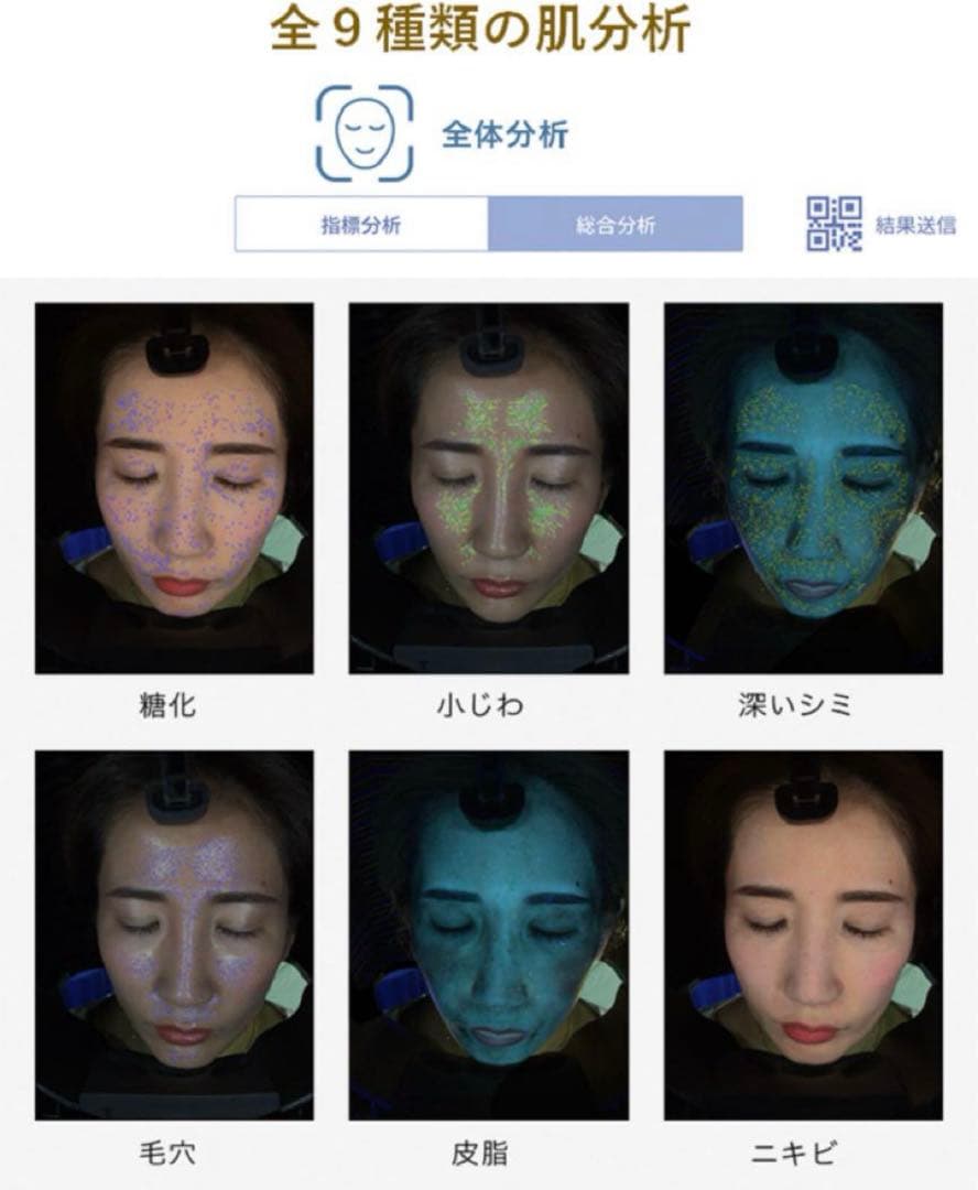 ！今日だけ大特価！早い者勝ち【iPad付き！】肌診断機器 アクサフェイス