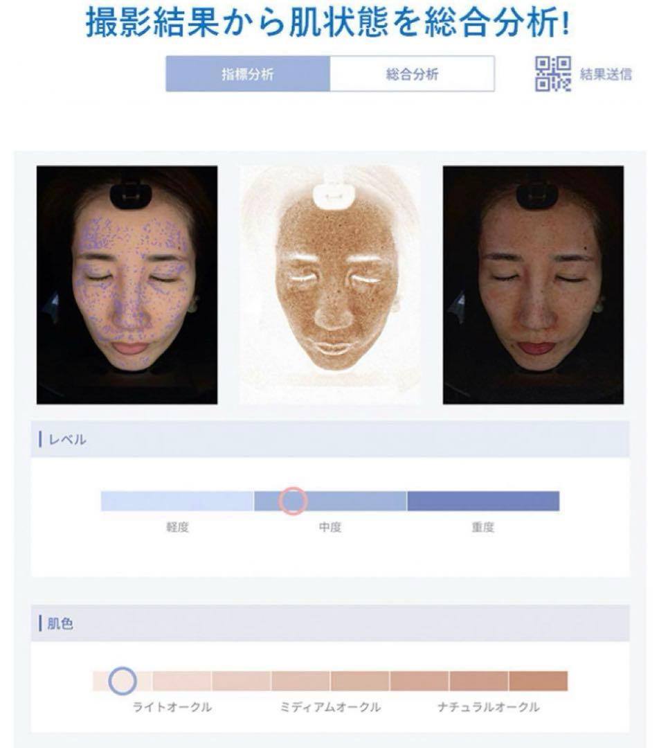 ！今日だけ大特価！早い者勝ち【iPad付き！】肌診断機器 アクサフェイス