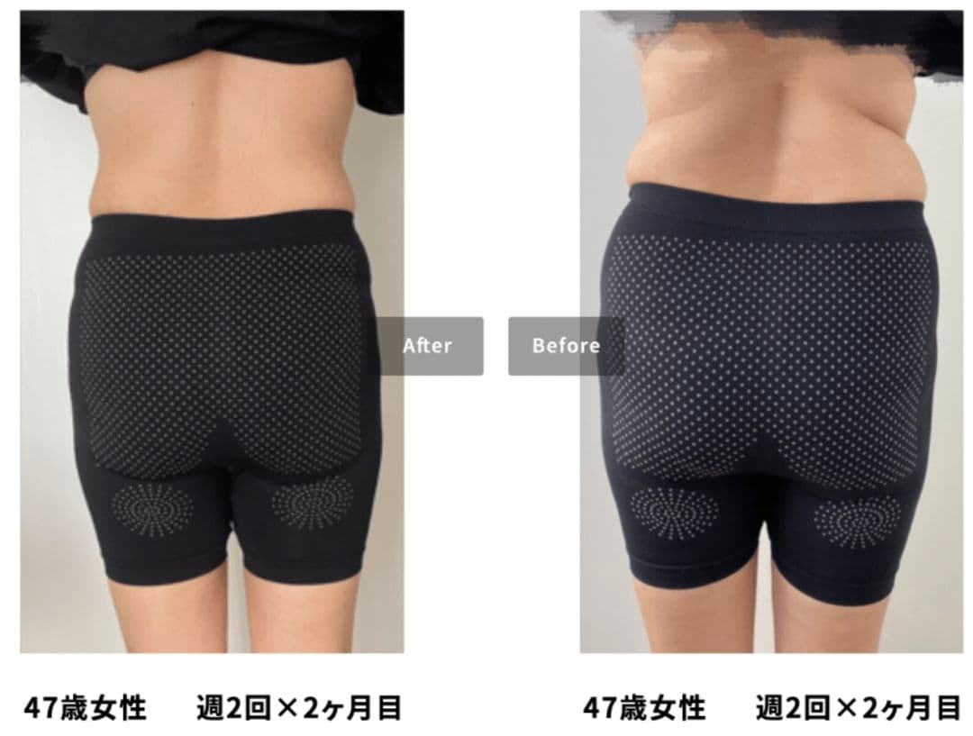 BeatOne 美容機器 ハンドピース付き