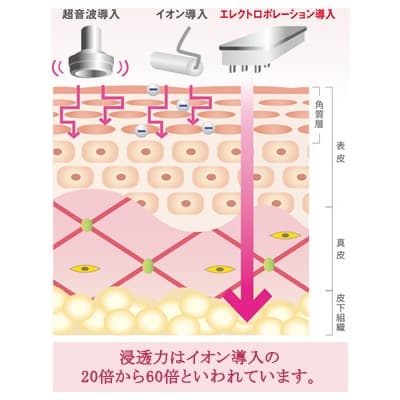 エポスキン　業務用美容機器　業務用エステ機器　エレクトロポレーション　毛穴洗浄
