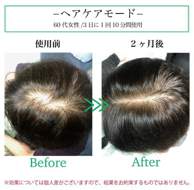 【未使用】 クールプロジェクト レディッチトリプロ 家庭用LED美容器