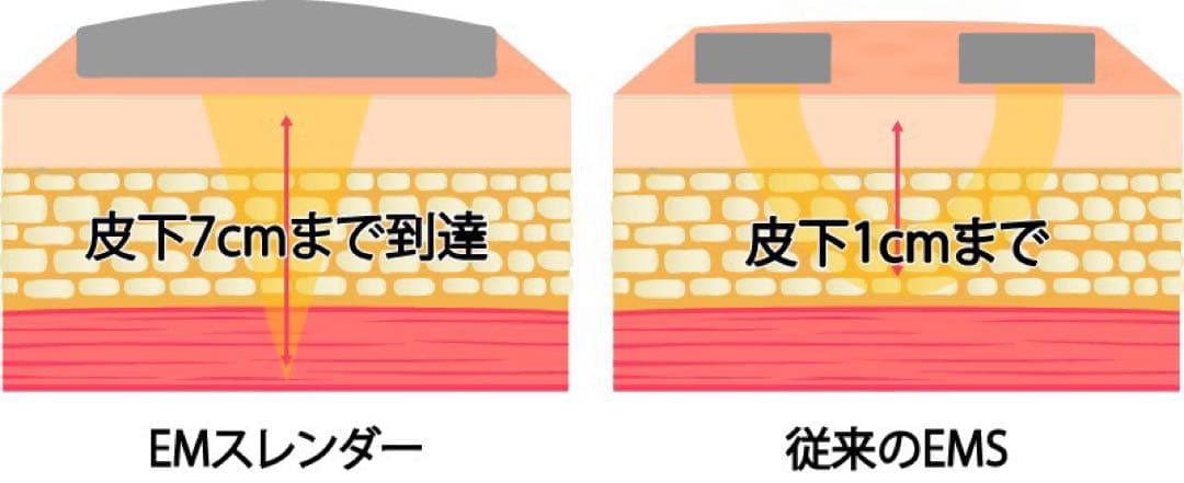 エムスレンダー　業務用　エステ器械