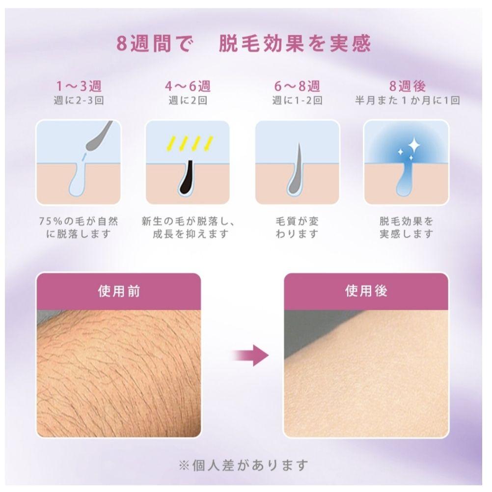 値下中！脱毛器 フラッシュ 脱毛機 家庭用 VIO 自動照射 新品