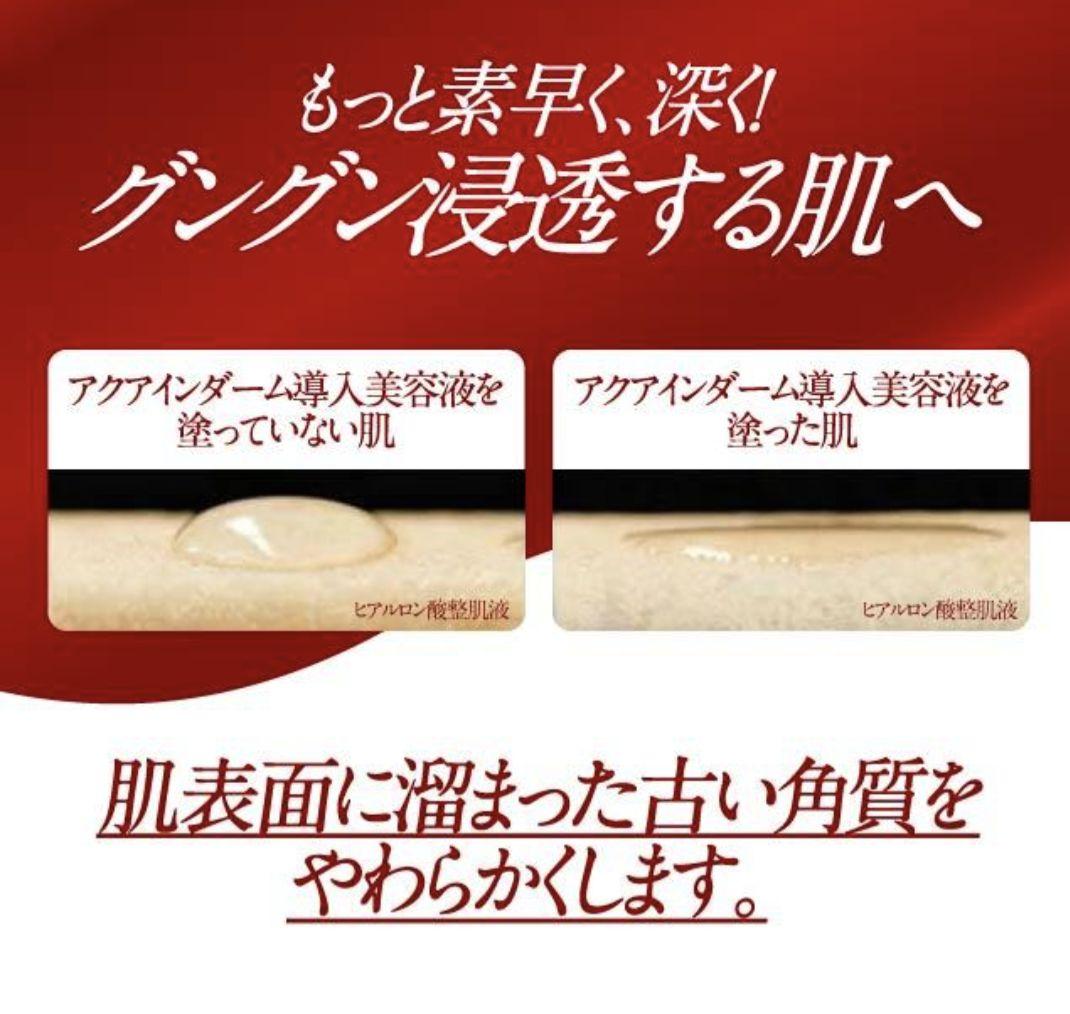 エンリッチリフト EXR 200g　VC100 エッセンスローション　導入美容液