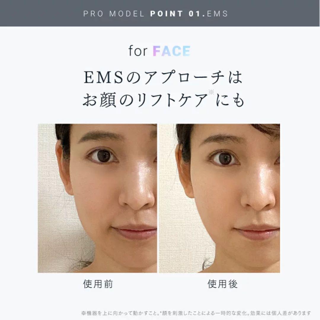 ボディ・フェイスケア MYTREX EMS HEAD SPA PRO