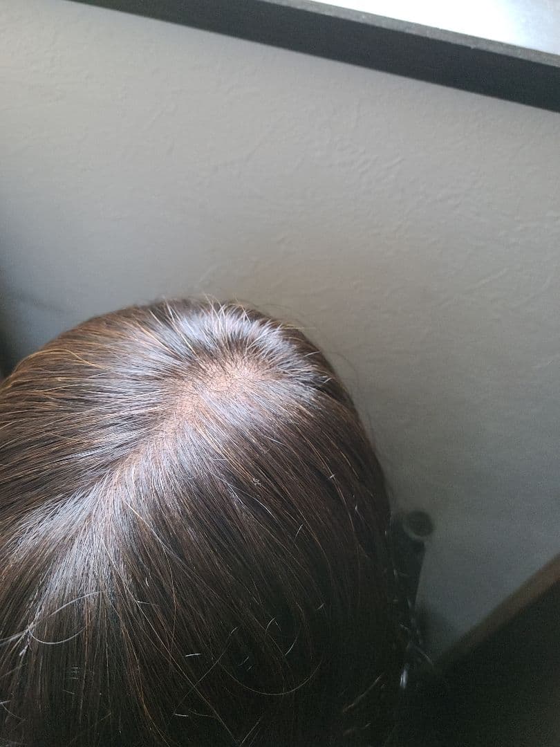 医療用ウィッグ　フォンテーヌ　ラフラ　アイフィット　クレア