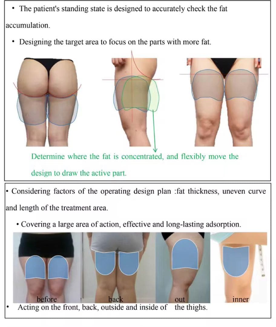 最新脂肪冷却＋電磁パルスマシン、クライオ、美品、痩身+360脂肪冷却痩身＋シート