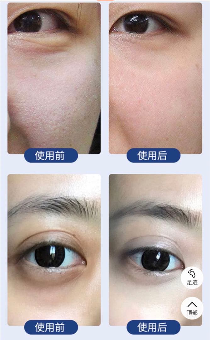 フェイスボディ複合美容機器