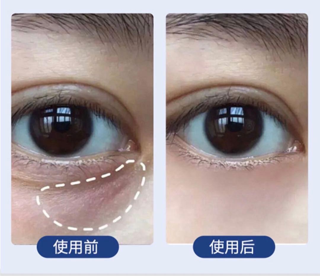 フェイスボディ複合美容機器