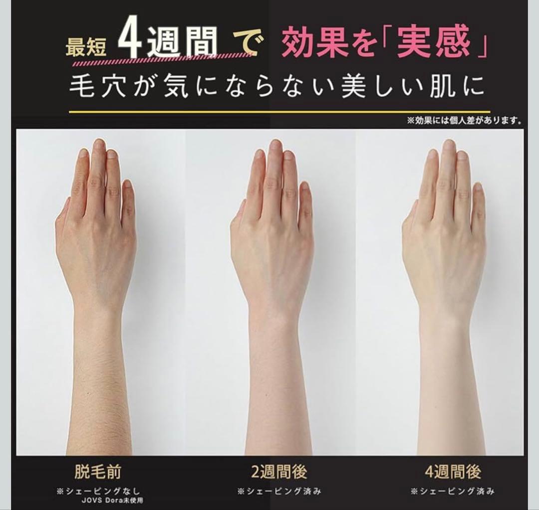 JOVS 脱毛器 エメラルド