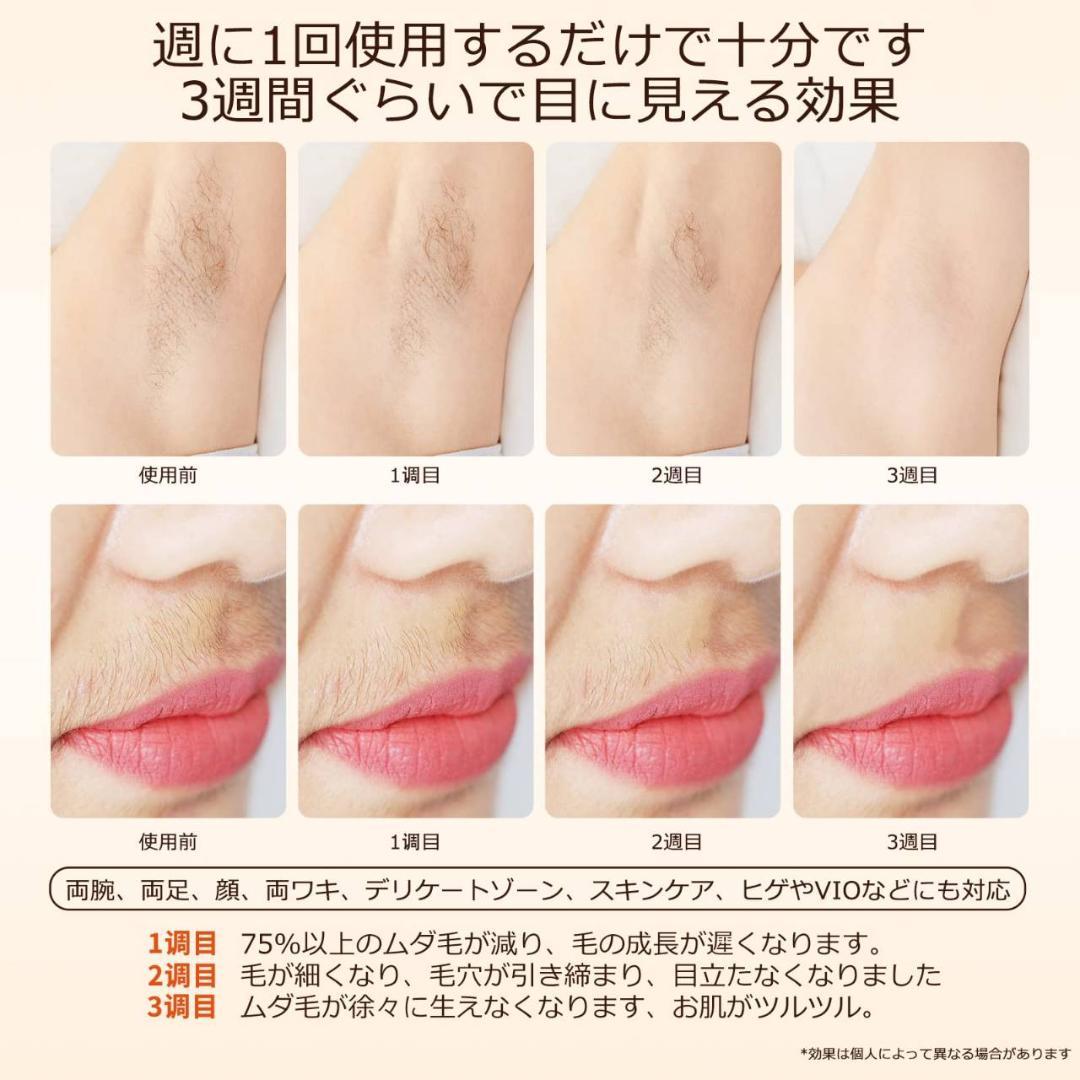 家庭用脱毛器 プロ仕様 男性もOK