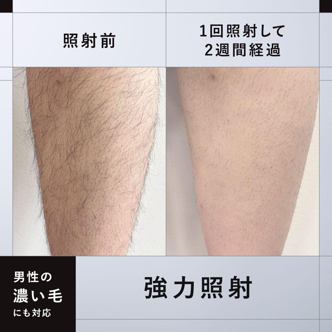 ⭐️新品未開封❣️マンダム ium (イウム) スピードショット 男性用ムダ毛脱毛器