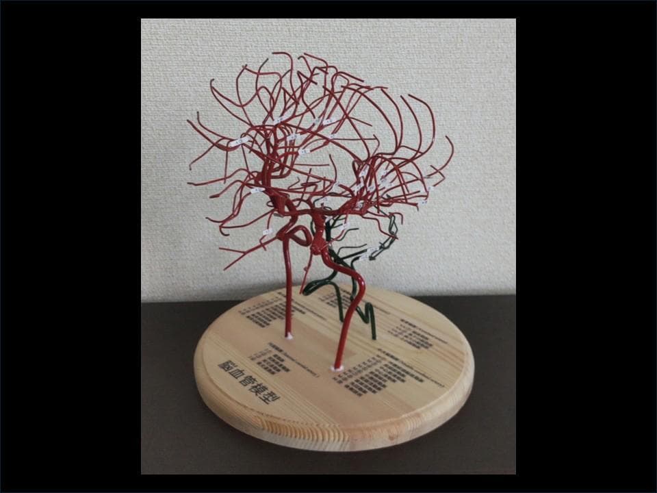 脳血管（内頚動脈、椎骨動脈）模型