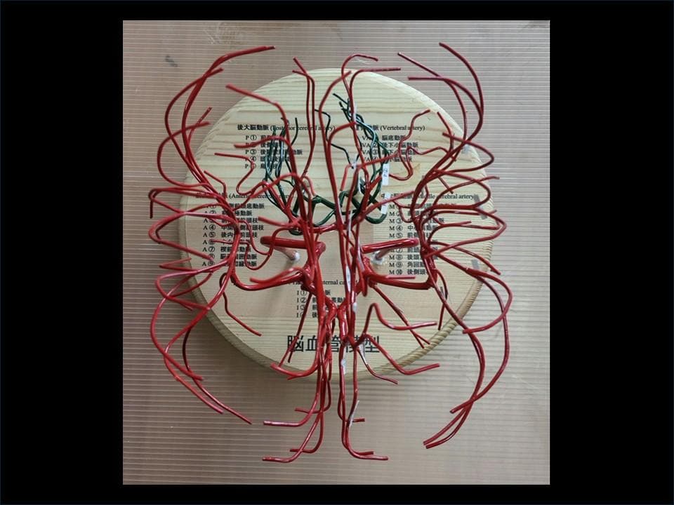 脳血管（内頚動脈、椎骨動脈）模型