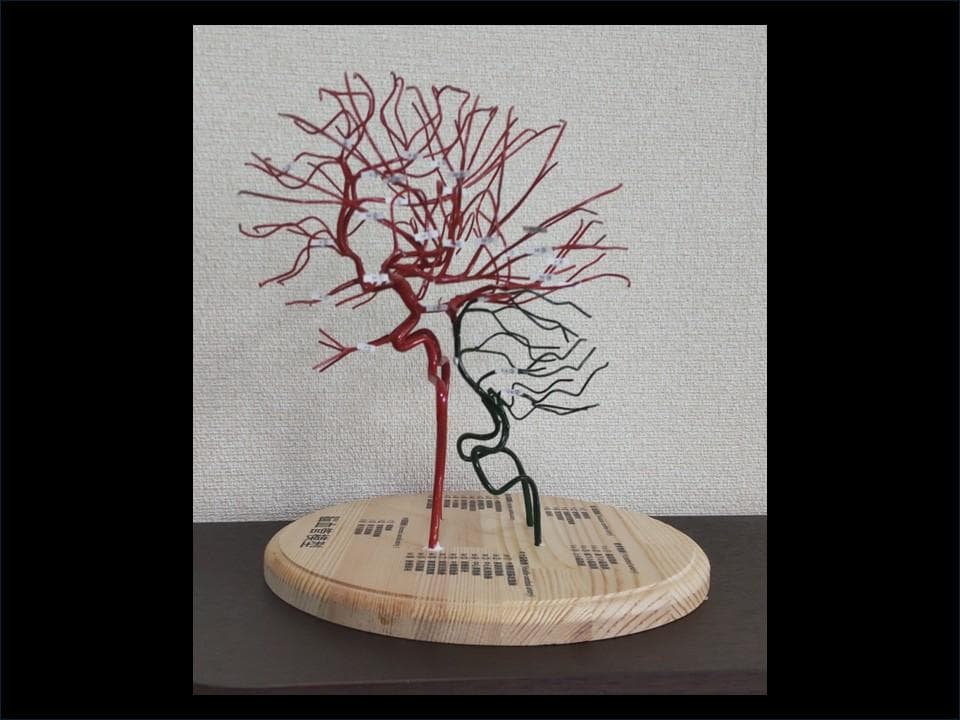 脳血管（内頚動脈、椎骨動脈）模型