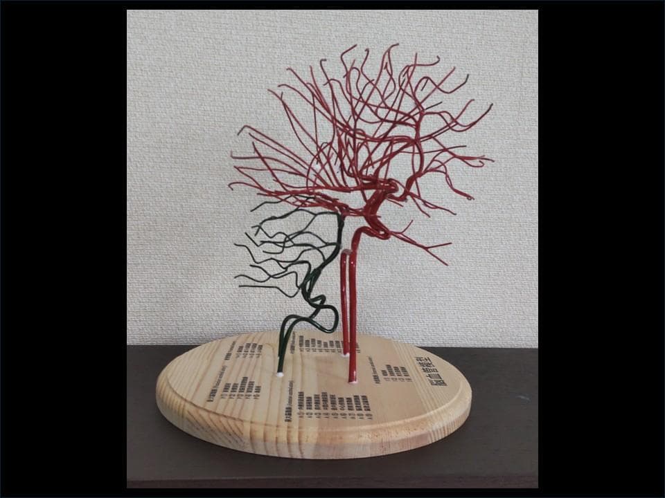 脳血管（内頚動脈、椎骨動脈）模型