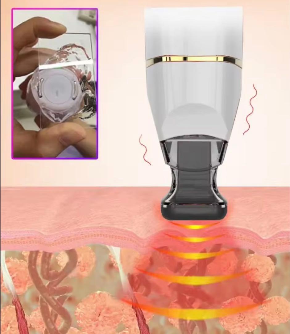 次世代リフトアップ　◽︎ サーマルフラクショナル ◽︎ フラクショナルRF 新古品