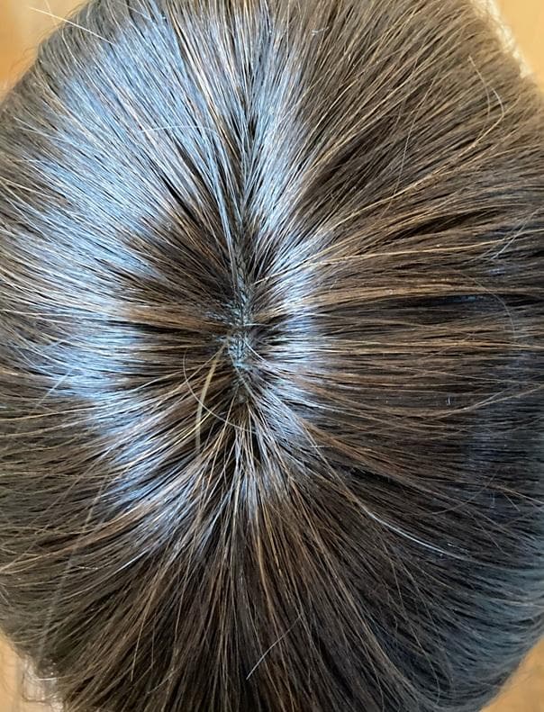 ふーちゃん　坂巻哲也　人毛MIX「ショート」　ダークブラウン