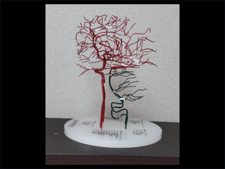 脳血管模型（内頚動脈、椎骨動脈）