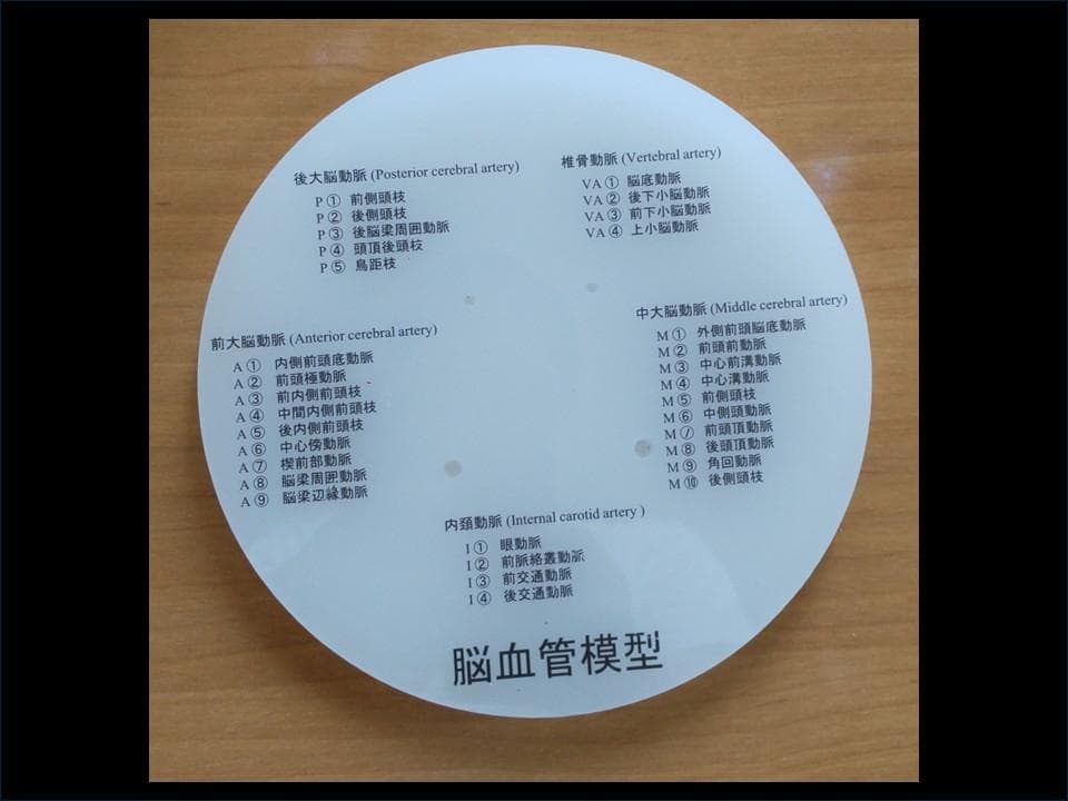 脳血管模型（内頚動脈、椎骨動脈）