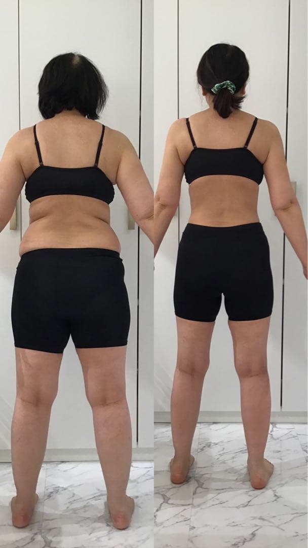 未使用品　アミン　リファイン　シュール　痩身機器