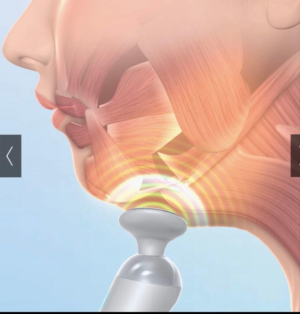 スタイリーフェイス美顔器