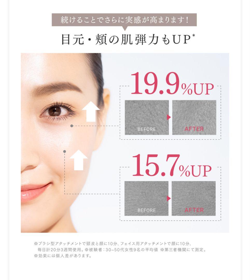 美品ゲル5本おまけ付き　MYTREX PROVEマイトレックス プルーヴ 美顔器