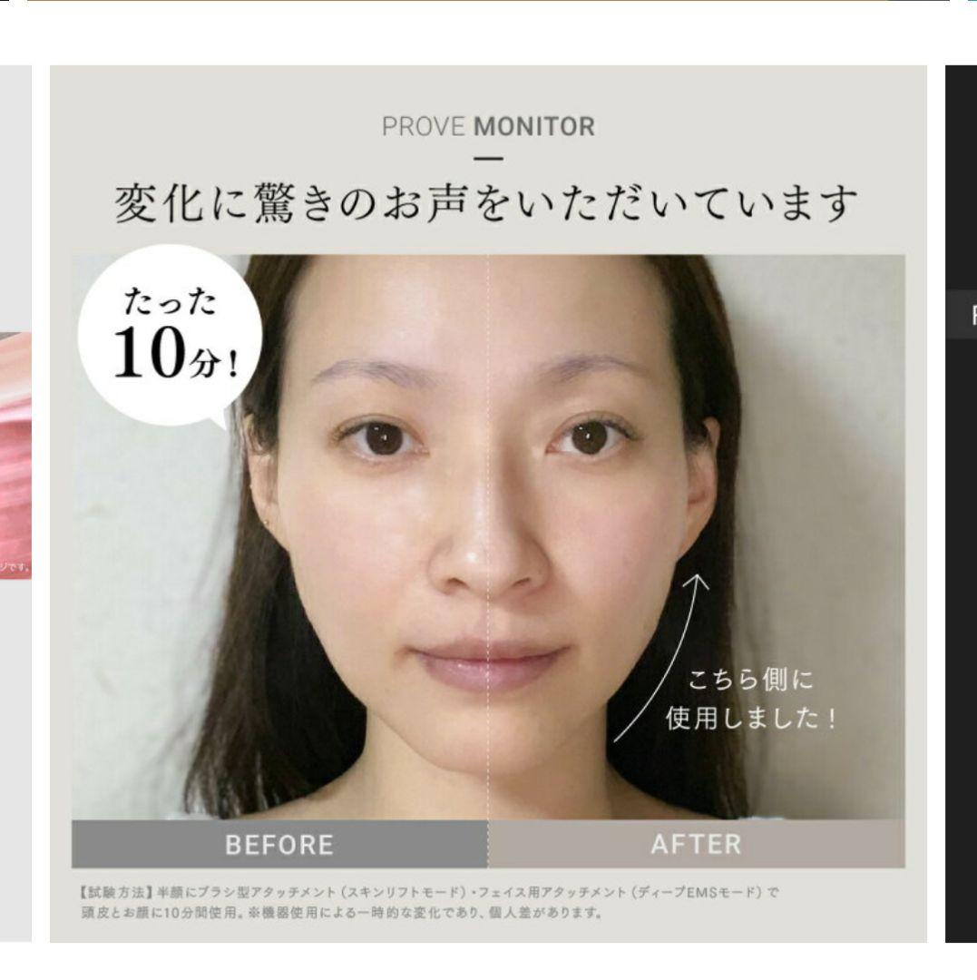 美品ゲル5本おまけ付き　MYTREX PROVEマイトレックス プルーヴ 美顔器