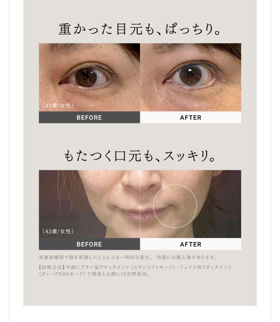 美品ゲル5本おまけ付き　MYTREX PROVEマイトレックス プルーヴ 美顔器