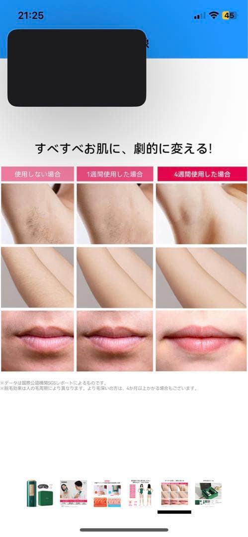 レーザー脱毛器