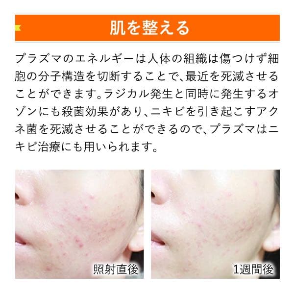 プラズマと微弱電流でリフトケア・ハリ、トーンに効くオールインワン美容機器です。