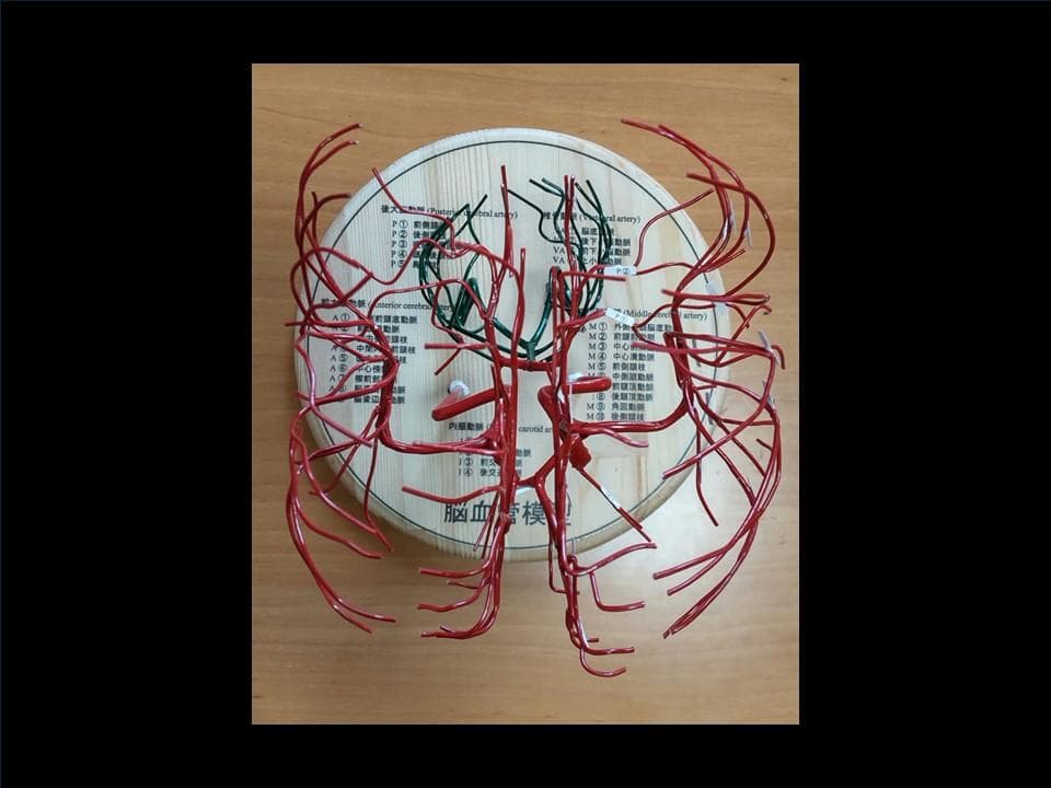 脳血管（内頸動脈、椎骨動脈）模型