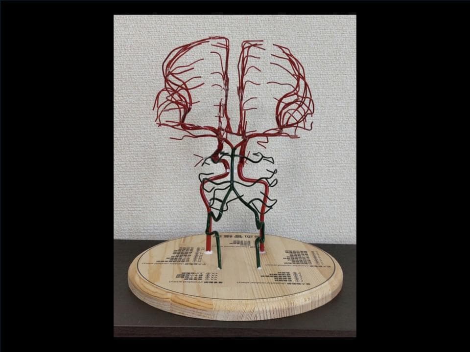 脳血管（内頸動脈、椎骨動脈）模型