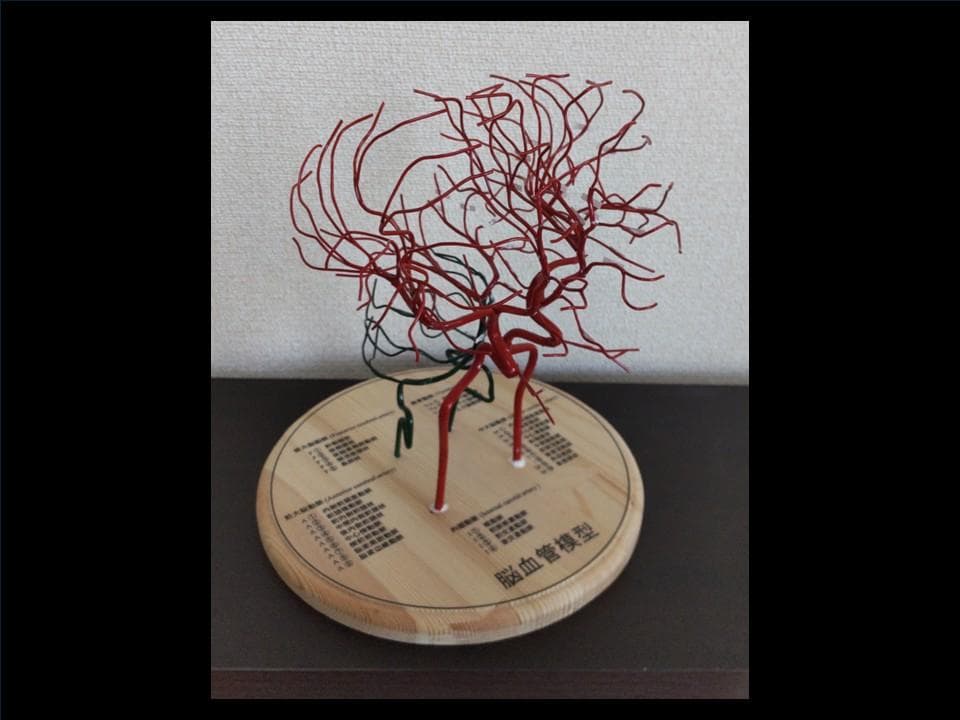 脳血管（内頸動脈、椎骨動脈）模型