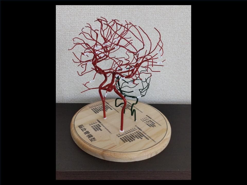 脳血管（内頸動脈、椎骨動脈）模型