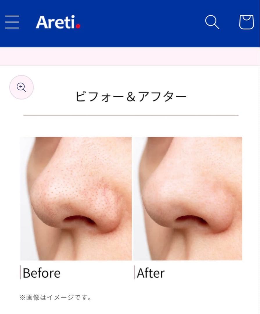 アレティ 毛穴吸引器 ホワイト　毛穴汚れ いちご鼻　黒ずみ　角栓