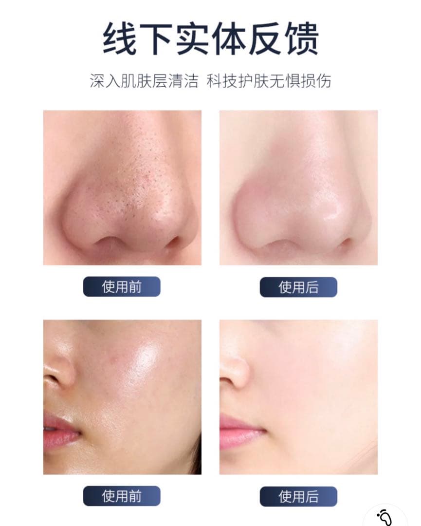 最新版　業務用 毛穴洗浄 ハイドラフェイシャル 美顔