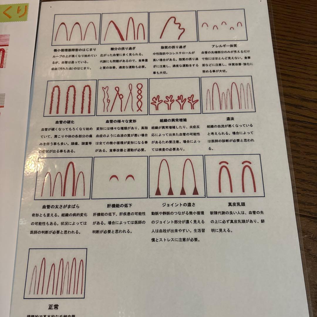 血流観察装置BscanPRO