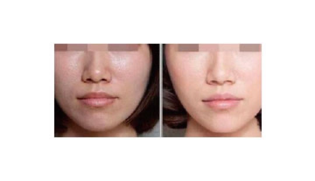 antimir アンティミル　真実の鏡 LED 美容