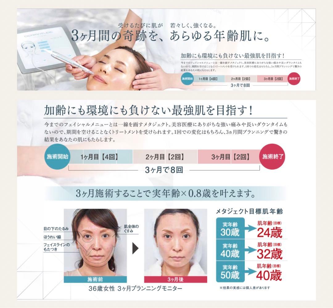 メタジェクト/しわシミ美容器具／エステ機器/美容パック/ダーマペン、医療エステ