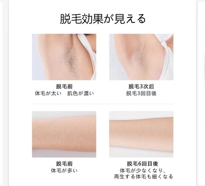 【新品未開封】FASIZ　家庭用脱毛器