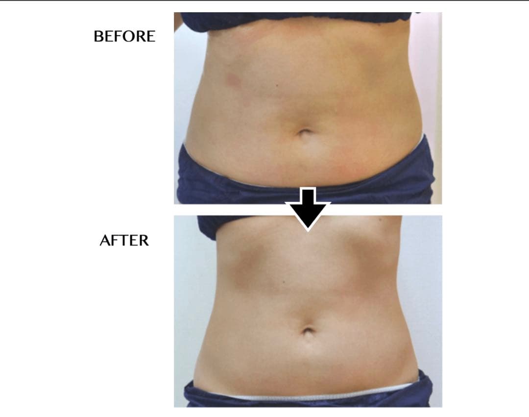 じぶんdeエステ CELLZERO FAST エステマシン